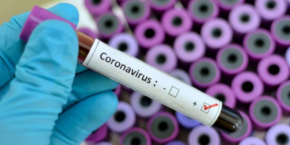 Coronavirus: More Troubles As Kano Records 92 Fresh COVID-19
