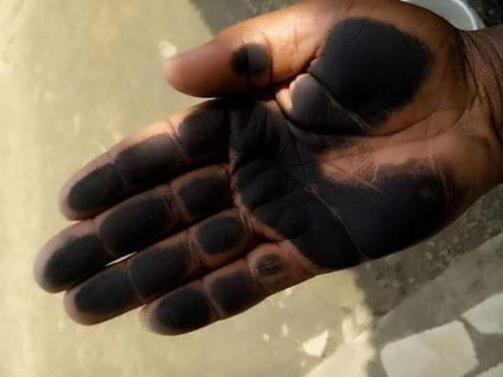 Rivers State: Soot And The Dangers Of Its Emission, A Call F